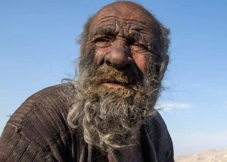 «Самый грязный человек в мире» помылся впервые за 63 года и умер