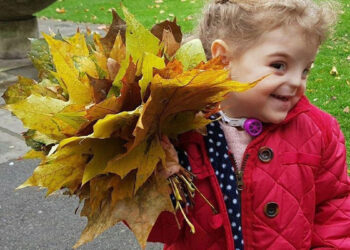 Увидев ее, врачи онемели – бедняжка родилась без носа. Вот какой она выросла: фото