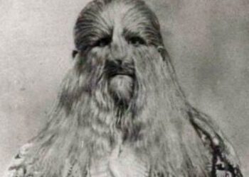 Мать звала «мерзостью»: трагическая жизнь «полульва-получеловека»