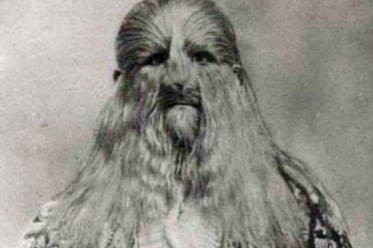 Мать звала «мерзостью»: трагическая жизнь «полульва-получеловека»