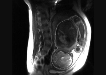 Беременная сделала МРТ и пришла в ужас от снимка. Смотрите сами