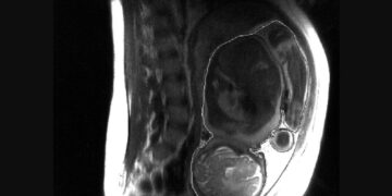 Беременная сделала МРТ и пришла в ужас от снимка. Смотрите сами