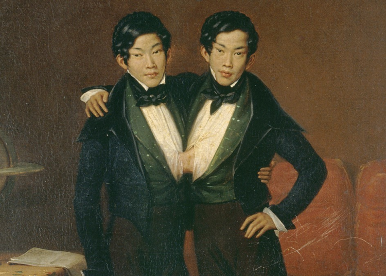 Накажут ли сиамских близнецов, если один из них совершит преступление