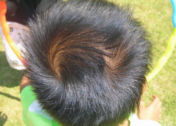 Что означает двойная макушка – знак судьбы или симптом болезни