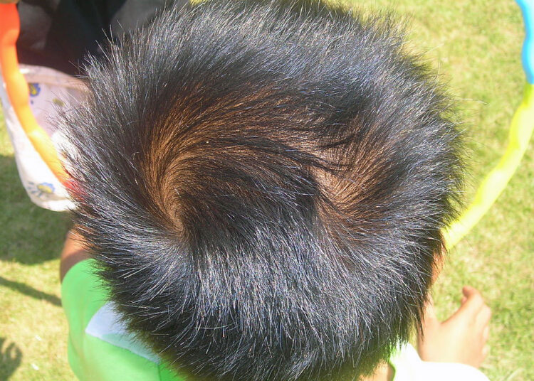 Что означает двойная макушка – знак судьбы или симптом болезни