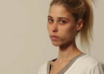 Как модель Карина Бауман уморила себя голодом и умерла в 35 лет