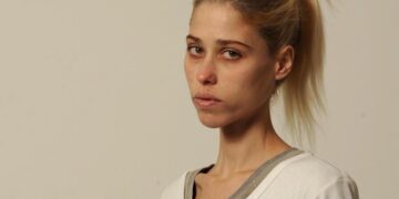 Как модель Карина Бауман уморила себя голодом и умерла в 35 лет