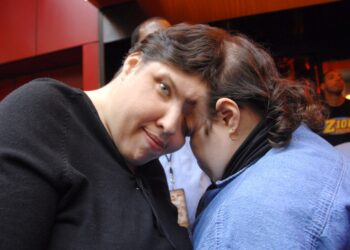 Сиамская близняшка рассказала об интимных моментах с мужчинами