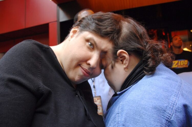 Сиамская близняшка рассказала об интимных моментах с мужчинами