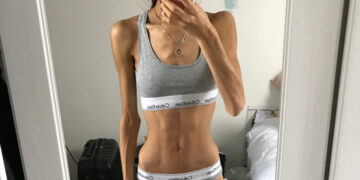 Волшебный «Оземпик»: как на нем худеют и как потом страдают