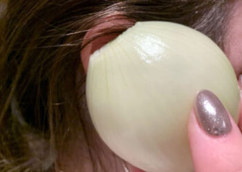 Что будет, если на ночь положить в ухо кусочек лука