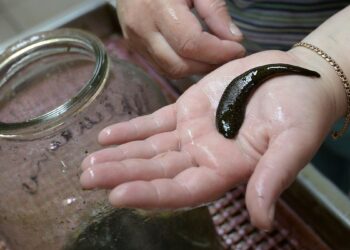 7 пугающих и отвратительных, но неожиданно эффективных медицинских процедур